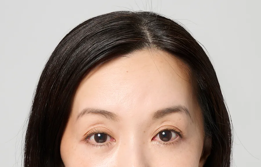 シェーディングで小顔にafter